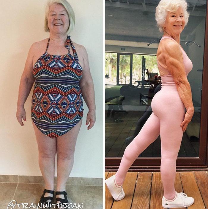 73-летняя женщина похудела и занялась фитнесом.