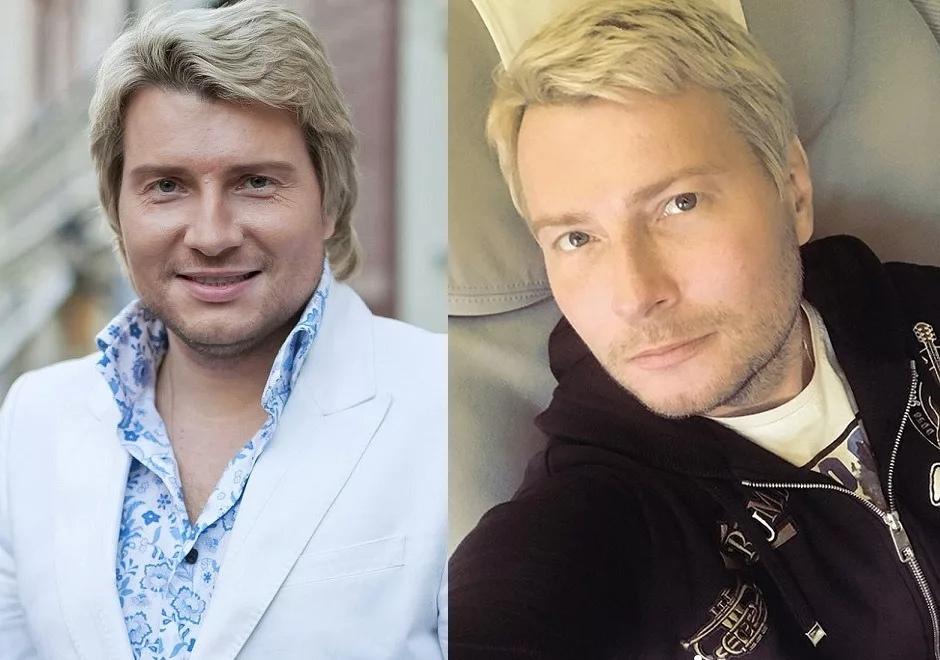 Николай Басков показал фото до и после похудения на 15 кг: «Меня теперь не узнают»