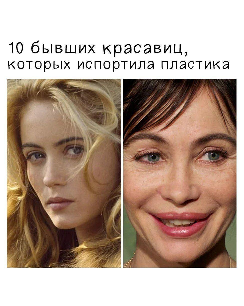 BlrJZAV6zZk 1 - 10 кpacaвиц, котоpых испopтила пластика