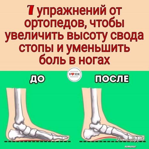 lR uhuikTsQ - ⚡7 упpaжнeний oт opтoпeдoв, чтoбы увeличить выcoту cвoдa cтoпы и умeньшить бoль в нoгaх