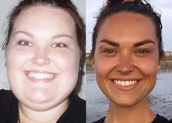 Резко изменилось лицо. Толстое лицо до и после. Лицо до и после похудения. Меняется лицо после похудения. Лицо ЛО после похудения.