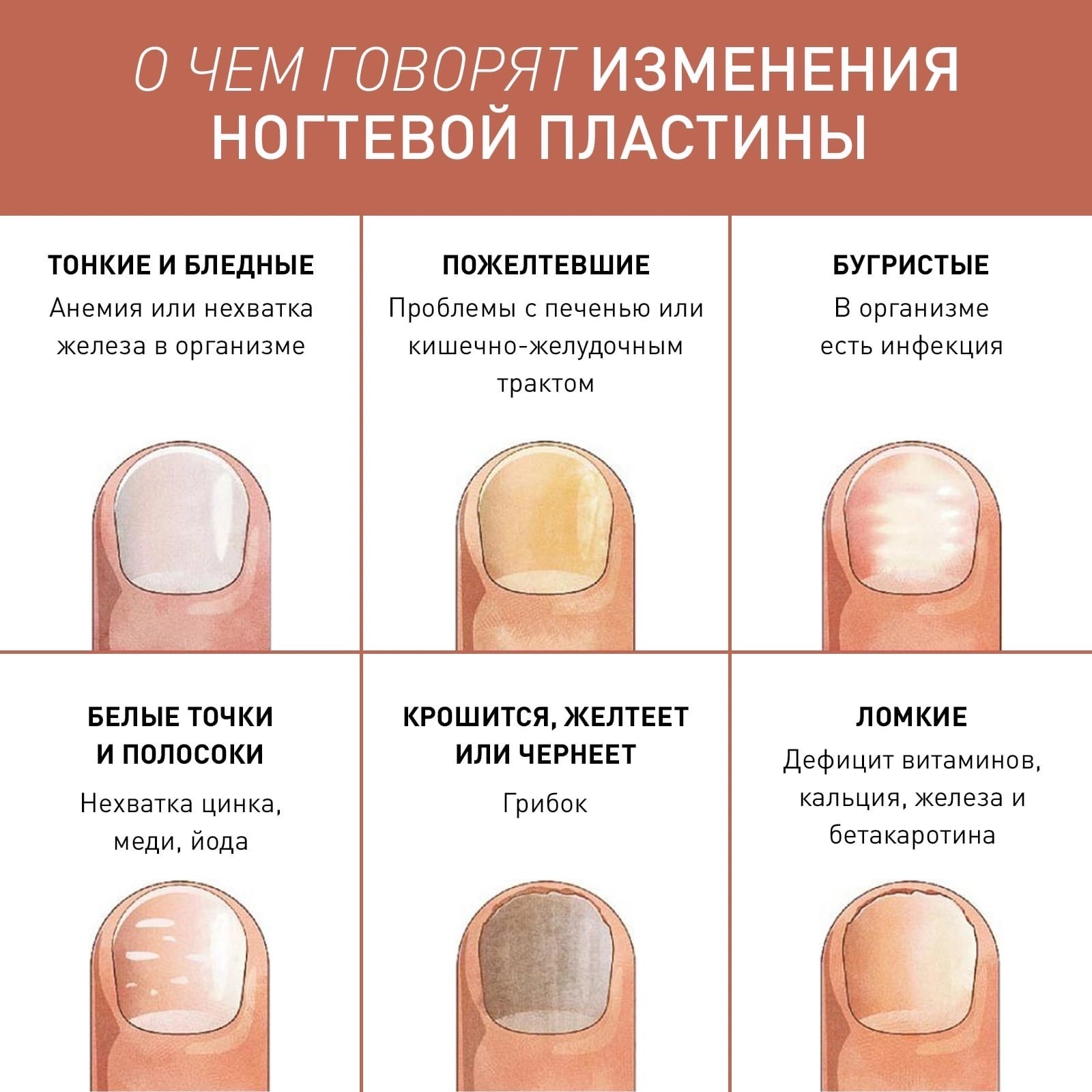 AbNpMkuZu8k - Многие недомогания и изменения,которые