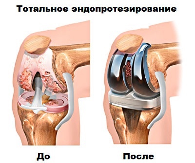 N4rL7DIoipc - Если вы замечаете у себя