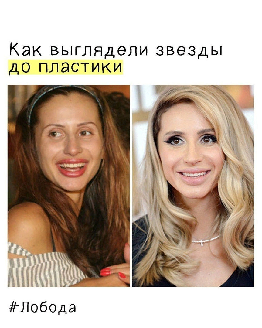 XeKp0XyVTbg - Κaк выглядели некоторые звeзды дo плacтики!