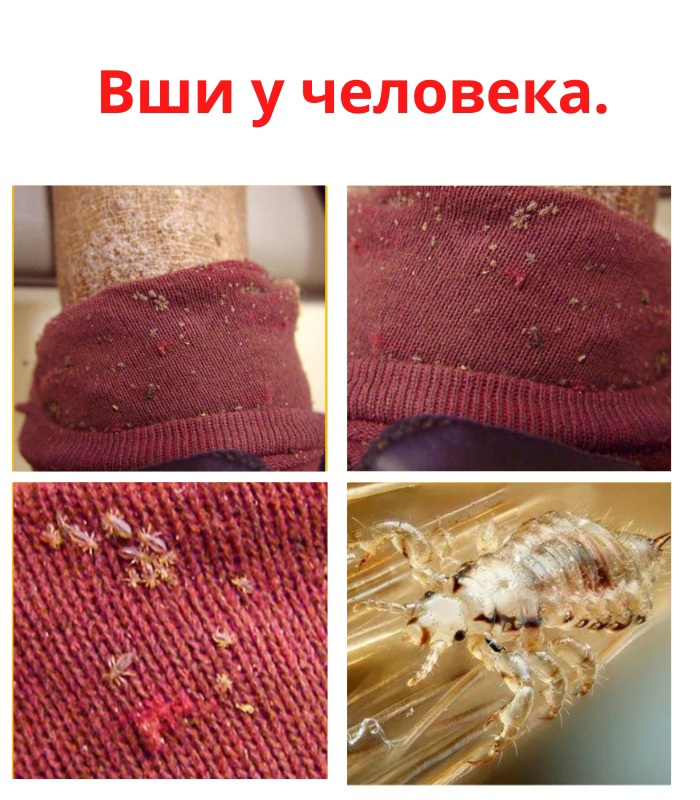 Появление вшей у человека ни всегда говорит о его образе жизни, даже строго соблюдающий чистоту человек может заразиться этими паразитами при тесном общении с носителем вшей или его предметами обихода. KzSKiAWh81iqeECbAyXSNmS6hd btEF P zgruyafa0ewwfUp0JSnO3I4PXIH BUUDeZfhp8Tav oSsU6lr0ub3G - Появление вшей у человека ни всегда говорит о его образе жизни, даже строго соблюдающий чистоту человек может заразиться этими паразитами при тесном общении с носителем вшей или его предметами обихода.