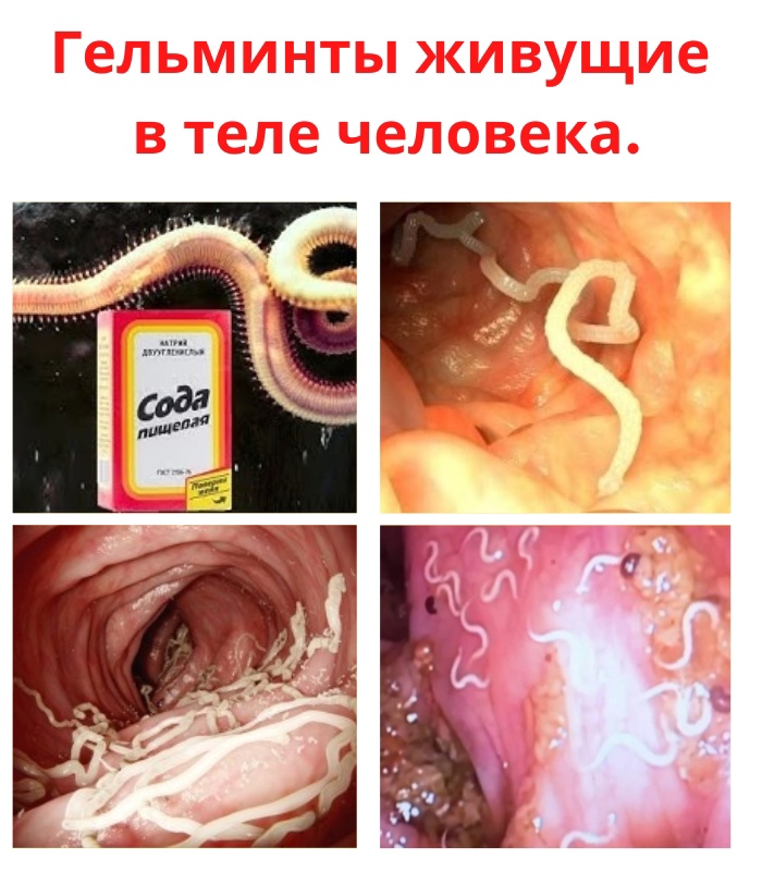 bLuIz61NcxR64td2zTPQhw5aoVAFp0GapAaGUAr1zfWCfnkvjCEpN6kN6uf2KPN6fwRLzsyYb6THH9gmMlasklxI - Заражение человека паразитами возможно при употреблении в пищу необработанного термически мяса, не вымытых фруктов или зелени.