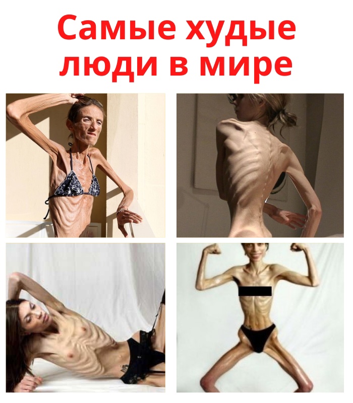 GgjVIQL DVTg6mp0JBCz5uZfetB 3unIfcA1Z1c80YaH08YtRLwbt7hmjvgJzoVIu2W8U4YnMJDh1xfFOIB84J5d - Анорексия является психическим нарушением.