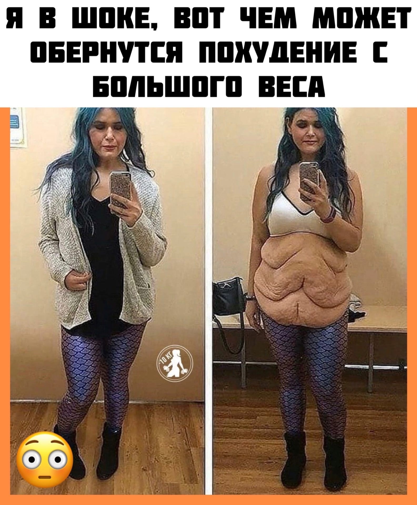 CIxapmceskuDZ1P2XDH6PMdVnljqmLM6ctmX5trYTy 8WSjnhmf2CBpU MALqsUm0GOb6r5DIg2MwZE91m3ovkge - Реальное фото девушки, которая сбросила огромный вес!
