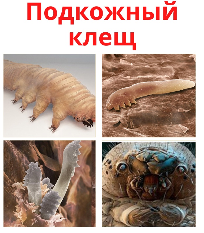 uLEk0BVJCbxGKW5U8Vdb5CgBnKOIELaiBI0hLrNLY2pWNPrKsg0w2uMJ9YPY529UEUeBfL0M7 kKXZQbSFsvWqcO - Подкожный клещ живет и размножается в волосяных фолликулах головы или ресниц.