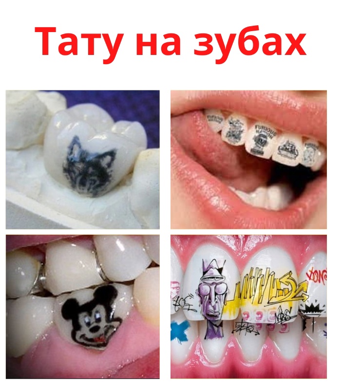 vWC1pjrJWg63Bme mnrwBOSvkKmJXMDet7anF Yk2TLppvc9bzp0kJBFXujkchmtNl ln5C4OFsr VYF1KlwZbJr - Татуировки на зубах.