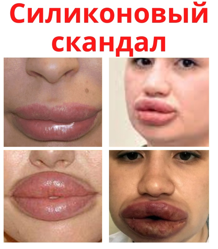 Процедура по увеличению объема и изменению контура губ в современном обществе пользуется спросом. Yw6OvmY5c53jhvO0J4nu7qGqFFh1VEbhG89AmOEZcEAS8LxouYOFuq8KuxQu1mCEA91sN eSF0F7jSHGtqayQt1M - Процедура по увеличению объема и изменению контура губ в современном обществе пользуется спросом.