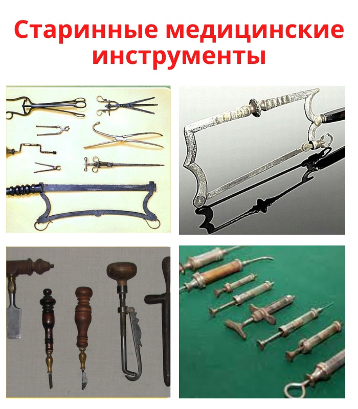 mEv6XFgbUAihOPpWCFiI2PNzur5AK4W7cL7Q06VhAMFcoA24dhL9P 7DSGfMEWtl2ZClHvSf6hqsVctF2VIXjsYG - Подобными медицинскими инструментами пользовались доктора XVI века.