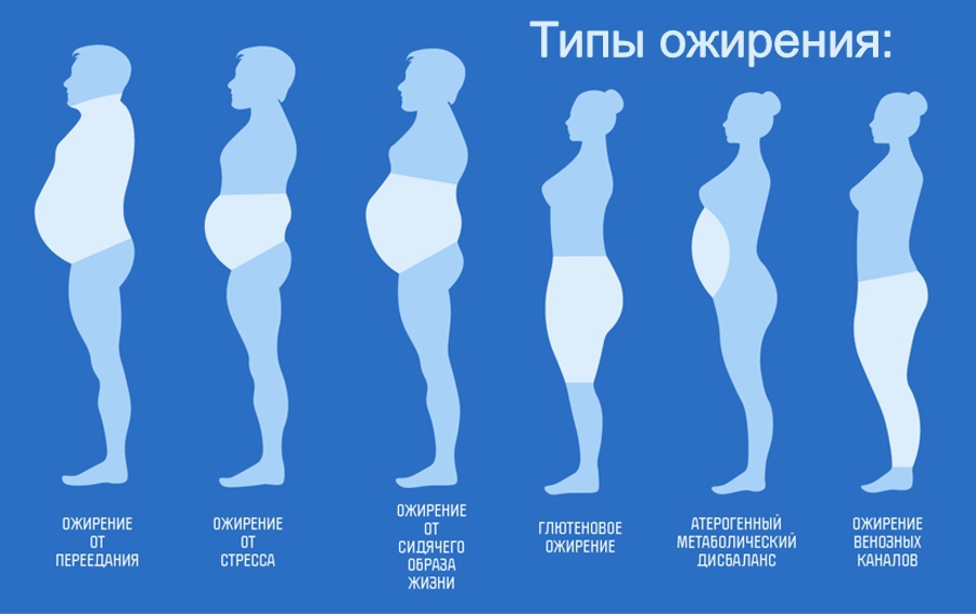 pptsa02pvcsdQBHih596xohWS7dguXy4mVLiwAE3Komh6bPM9DFAl3adHVJj49edDevi5wDf7d2GRIR5SlvNF3PI - Варианты жировых отложений, а какой тип у вас?