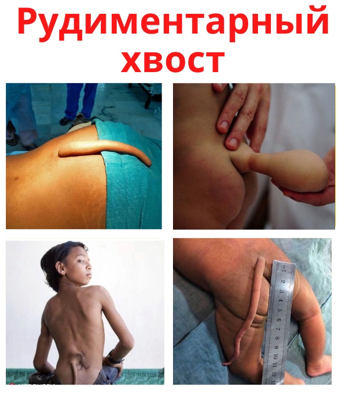 Js7NCFFZ15MtKCfB27bSB9HAk9PpL4N7x8u1mVw1rgoZvtactV6BsMplFxiqFARiT02Z58xuTyp mnPm1uL0fQc4 - Рудиментарным хвостом является полуфункциональный нарост укомплектованный нервами, кровеносными сосудами, кожей и мышцами.
