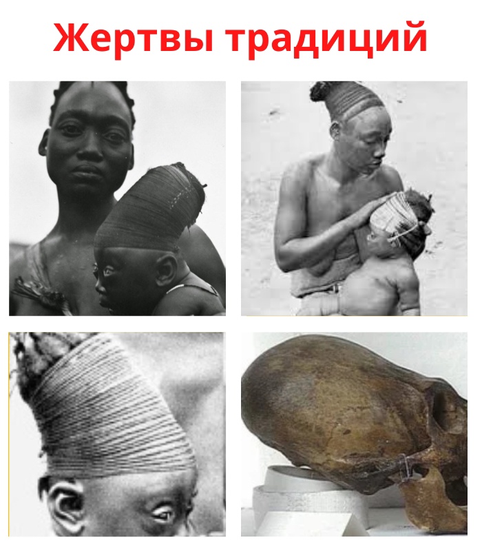Искусственная деформация черепа. qNW4rT4BkdscVbR1fa4DVNoTBU4932Cd nolWth2tPLIr0C7WlwhrBcGMSaUEd7NrVHueaRW2 bl0ODFyfT Leyr - Искусственная деформация черепа.