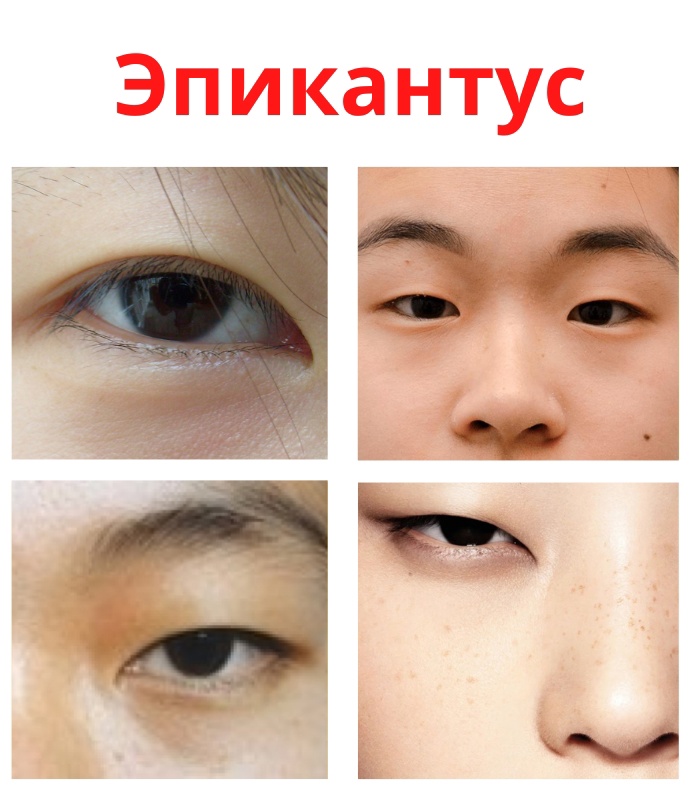x wS4 df0iaXTfYHxnVVbdF5Gc4G2v17bSasTX J7uYLlczXrytKcEzpAL2dbcM zVBkG871j8fQpJJloMJT0r6 - Кожная складка (эпикантус) на верхнем веке присутствует только у монголоидной расы.