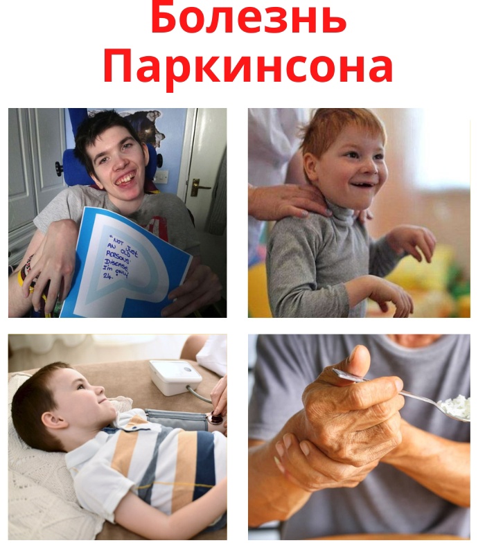 9qEobAg9SgY - Болезнь Паркинсона является заболеванием головного мозга при котором возникают нарушения двигательной функции, нарушается сон, возникают психические расстройства, боли в ногах и спине.