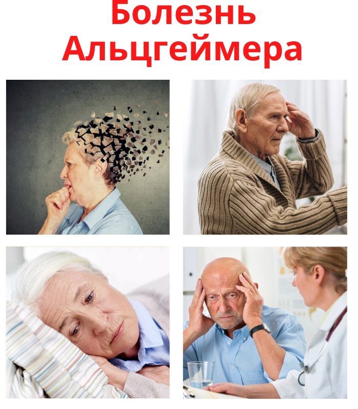 Болезнь Альцгеймера является распространенным типом деменции. o2DthZzr6 w - Болезнь Альцгеймера является распространенным типом деменции.